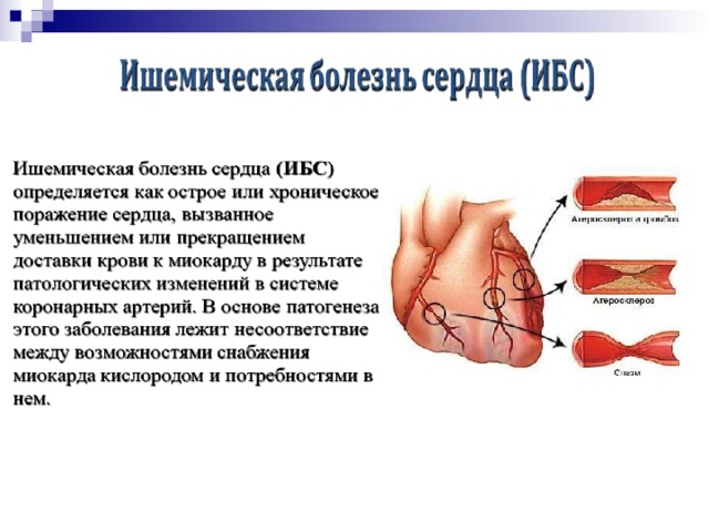 Заболевания сердечно сосудистой системы примеры