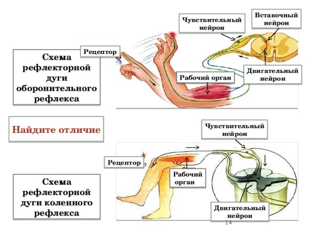 Вставочный нейрон Чувствительный нейрон Рецептор Схема рефлекторной дуги оборонительного рефлекса Двигательный нейрон Рабочий орган  Найдите отличие  Чувствительный нейрон Схема рефлекторной дуги оборонительного рефлекса - сложная рефлекторная дуга. Схема рефлекторной дуги коленного рефлекса - простая рефлекторная дуга. Отличие - отсутствие вставочного нейрона. Рецептор Рабочий  орган Схема рефлекторной дуги коленного рефлекса Двигательный нейрон   