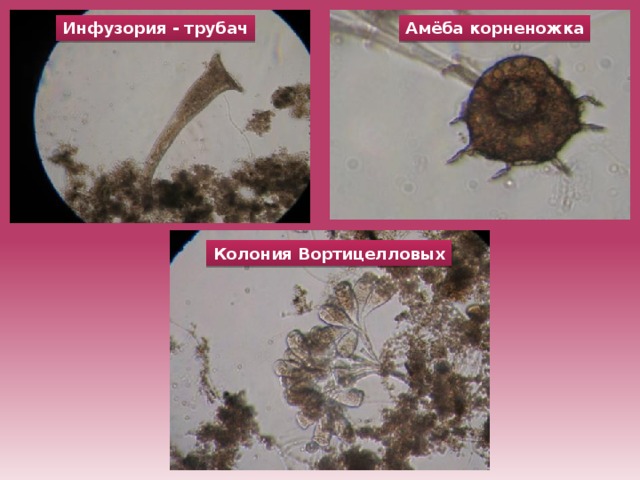 Амёба корненожка Инфузория - трубач Колония Вортицелловых 