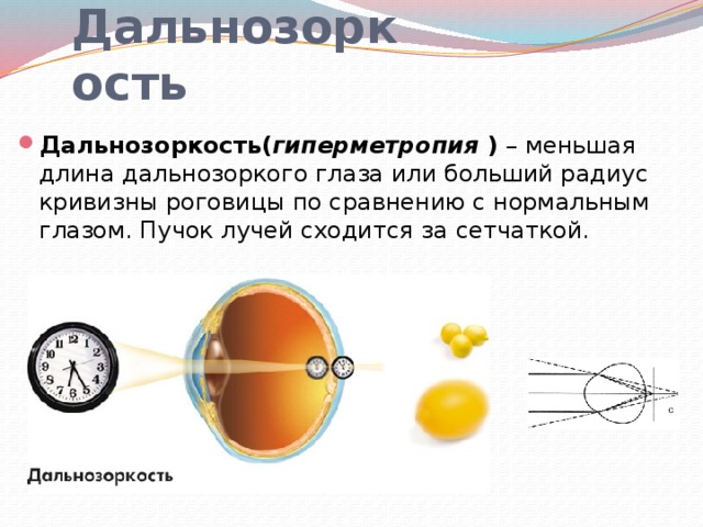 Презентация на тему дефекты зрения