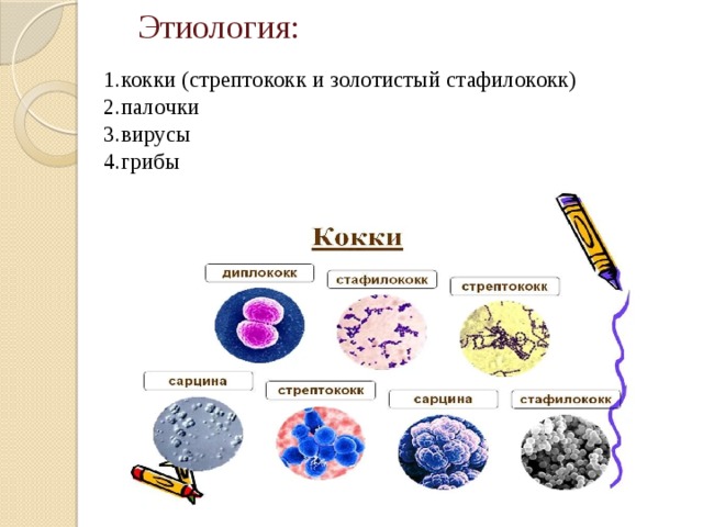  Этиология:   1.кокки (стрептококк и золотистый стафилококк)  2.палочки  3.вирусы  4.грибы   