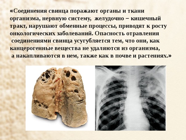 « Соединения свинца поражают органы и ткани организма, нервную систему, желудочно – кишечный тракт, нарушают обменные процессы, приводят к росту онкологических заболеваний. Опасность отравления  соединениями свинца усугубляется тем, что они, как канцерогенные вещества не удаляются из организма,  а накапливаются в нем, также как в почве и растениях. » 