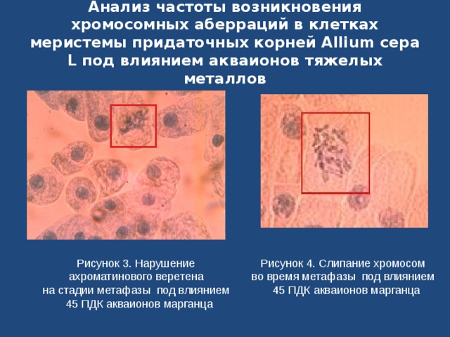 Анализ частоты возникновения хромосомных аберраций в клетках меристемы придаточных корней Allium сера L под влиянием акваионов тяжелых металлов Рисунок 3. Нарушение ахроматинового веретена на стадии метафазы под влиянием  45 ПДК акваионов марганца Рисунок 4. Слипание хромосом во время метафазы под влиянием  45 ПДК акваионов марганца 