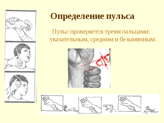 Места определения пульса картинки