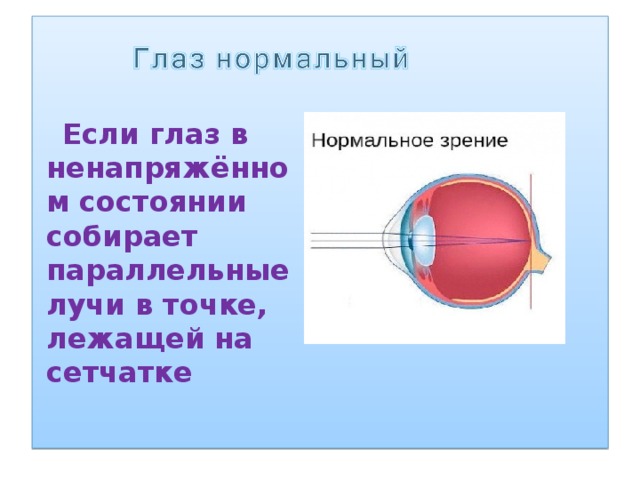  Если глаз в ненапряжённом состоянии собирает параллельные лучи в точке, лежащей на сетчатке 