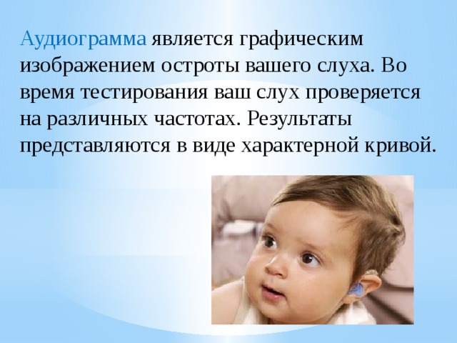 Аудиограмма является графическим изображением остроты вашего слуха. Во время тестирования ваш слух проверяется на различных частотах. Результаты представляются в виде характерной кривой.   