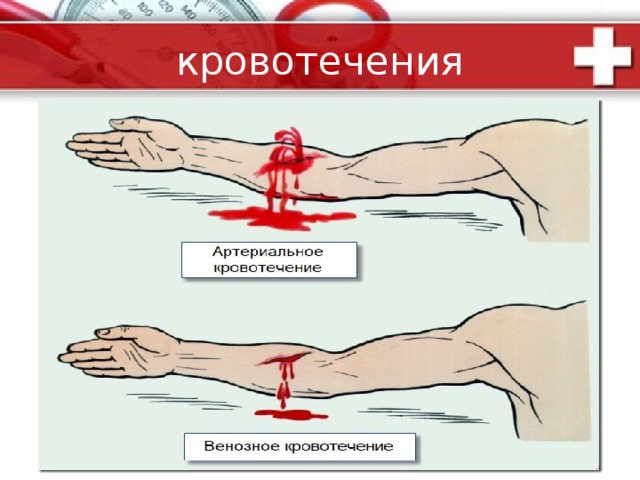 Первая помощь при отравлениях :  Промывание желудка . Независимо от природы химического или токсического вещества, его количества и времени попадания в организм, помощь следует начать с промывания желудка большим количеством (3-4 л) воды комнатной температуры до чистых промывных вод. Для этого Вы должны попросить пациента выпить за один прием как можно больше тепловатой, чуть подсоленной воды и вызвать рвоту , нажимая пальцами на корень языка. Такую манипуляция Вы должны повторить 2 - 3 раза, после чего дать пациенту 2 - 3 столовые ложки размятого активированного угля и слабительное. Если Вы знаете, что Ваш пациент отравился кислотой, ни в коем случае не надо пытаться нейтрализовать действие этих веществ щелочью (например, раствором соды) и наоборот. Бурно выделяющиеся газы могут вызвать разрыв в стенке желудка и содержимое изольется в брюшную полость. 