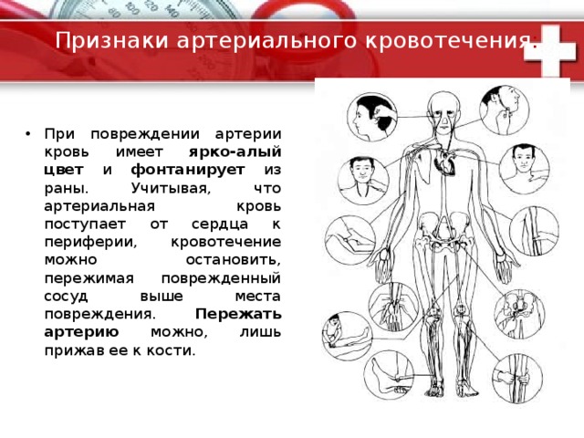 кровотечения 