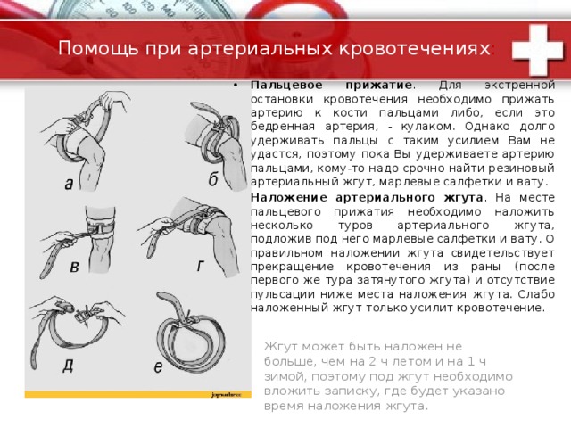 Схема наложения жгута при артериальном кровотечении