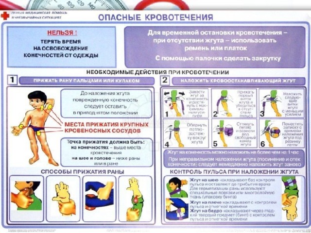 Помощь при артериальных кровотечениях : Пальцевое прижатие . Для экстренной остановки кровотечения необходимо прижать артерию к кости пальцами либо, если это бедренная артерия, - кулаком. Однако долго удерживать пальцы с таким усилием Вам не удастся, поэтому пока Вы удерживаете артерию пальцами, кому-то надо срочно найти резиновый артериальный жгут, марлевые салфетки и вату. Наложение артериального жгута . На месте пальцевого прижатия необходимо наложить несколько туров артериального жгута, подложив под него марлевые салфетки и вату. О правильном наложении жгута свидетельствует прекращение кровотечения из раны (после первого же тура затянутого жгута) и отсутствие пульсации ниже места наложения жгута. Слабо наложенный жгут только усилит кровотечение. Жгут может быть наложен не больше, чем на 2 ч летом и на 1 ч зимой, поэтому под жгут необходимо вложить записку, где будет указано время наложения жгута.  