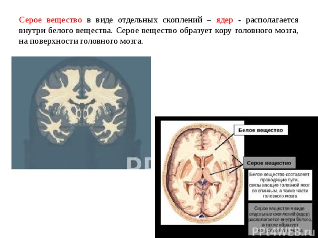 Общая схема локализации белого и серого вещества головного мозга