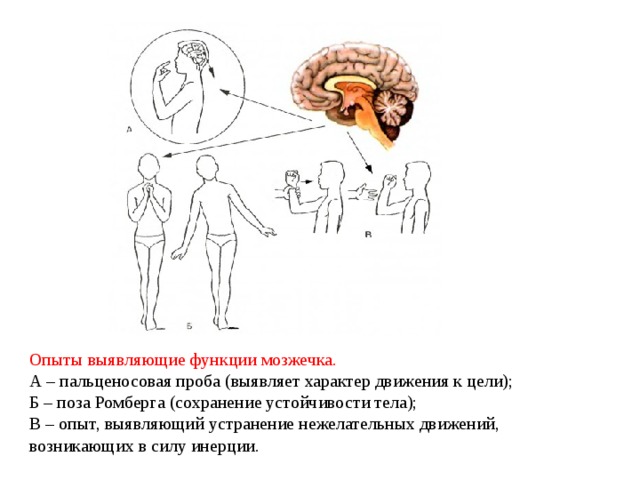 Опыты выявляющие функции мозжечка.  А – пальценосовая проба (выявляет характер движения к цели);  Б – поза Ромберга (сохранение устойчивости тела);  В – опыт, выявляющий устранение нежелательных движений, возникающих в силу инерции. 