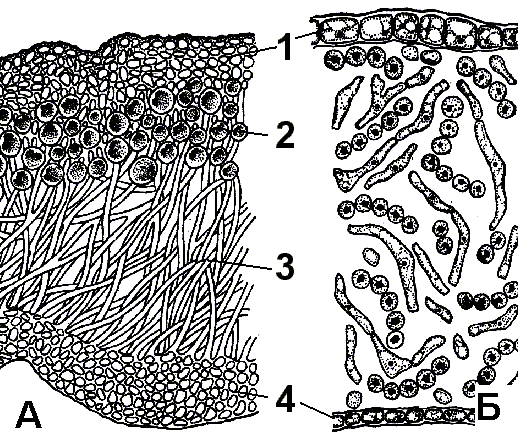 Рисунок лишайника под микроскопом