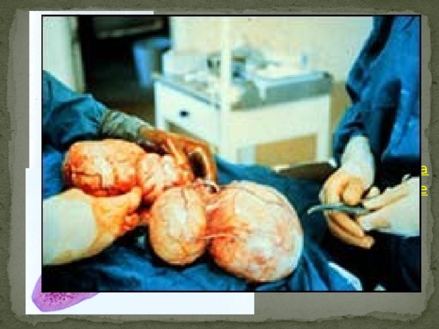 Царство: Животные  Тип: Плоские черви  Класс: Ленточные черви  Отряд: Cyclophyllidea  Семейство: Taeniidae