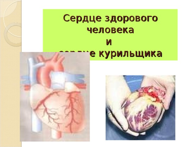 Сердце здорового человека  и  сердце курильщика
