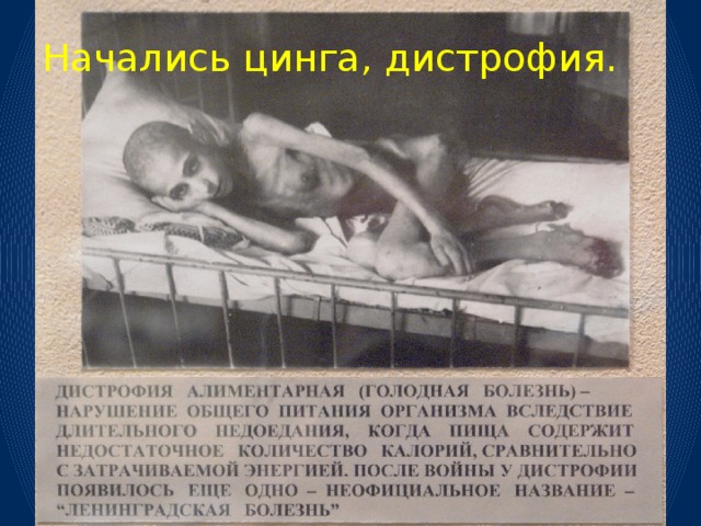 Начались цинга, дистрофия. 
