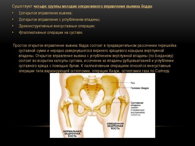 Вывих тазобедренного сустава карта вызова