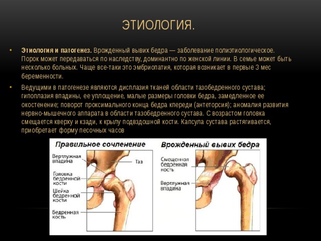 Врожденные ортопедические деформации; дисплазия тазобедренного сустава.