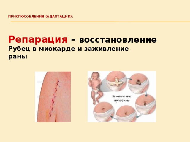  Приспособления (адаптации):    Репарация – восстановление Рубец в миокарде и заживление раны 