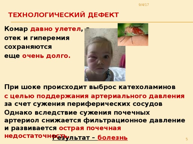 9/4/17 Технологический дефект   Комар давно улетел , а отек и гиперемия сохраняются еще очень долго.    При шоке происходит выброс катехоламинов с целью поддержания артериального давления за счет сужения периферических сосудов Однако вследствие сужения почечных артериол снижается фильтрационное давление и развивается острая почечная недостаточность. Результат – болезнь  
