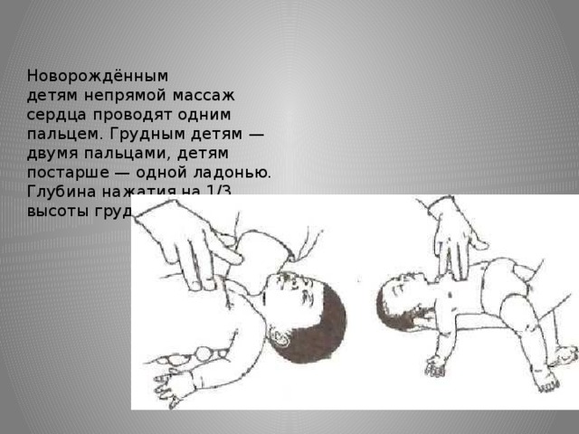 Какой должна быть глубина продавливания грудной клетки. Глубина продавливания грудины у ребенка при непрямом массаже сердца. При непрямом массаже сердца глубина продавливания. Непрямой массаж сердца у детей. Новорожденному ребенку непрямой массаж сердца проводят.