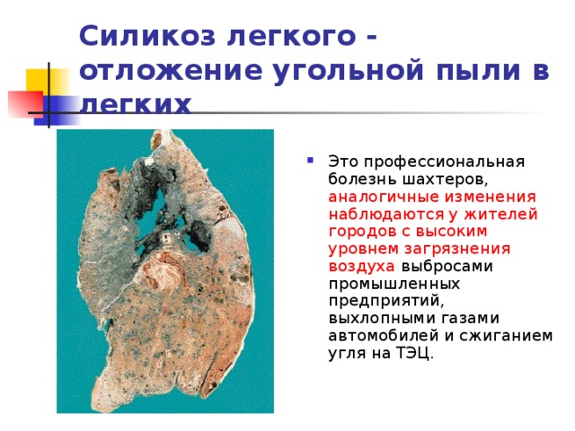 Профессиональные заболевания шахтеров презентация