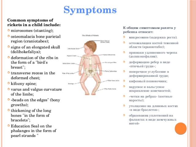 Symptoms Common symptoms of rickets in a child include: К общим симптомам рахита у ребенка относят: microsomes (stunting); osteomalacia bone parietal region (craniotabes); signs of an elongated skull (dolihokefaliya); deformation of the ribs in the form of a 