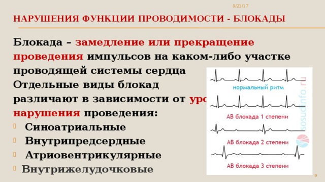 9/21/17 Нарушения функции проводимости - блокады   Блокада – замедление или прекращение проведения импульсов на каком-либо участке проводящей системы сердца Отдельные виды блокад различают в зависимости от уровня нарушения проведения:  Синоатриальные  Внутрипредсердные  Атриовентрикулярные Внутрижелудочковые 5 