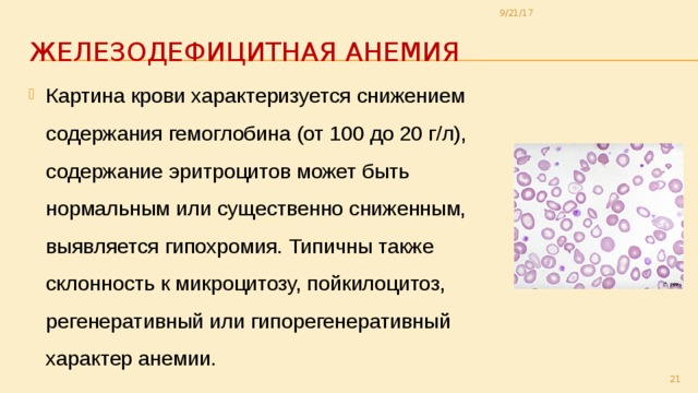 Изменения в крови причины. Картина периферической крови при железодефицитной анемии. Изменения периферической крови при железодефицитной анемии. Картина периферической крови при жда. Изменения в анализе крови при железодефицитной анемии.