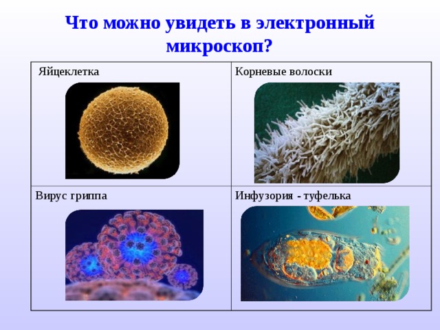 Что можно увидеть в электронный микроскоп?  Яйцеклетк а Корневые волоски Вирус гриппа Инфузория - туфелька 