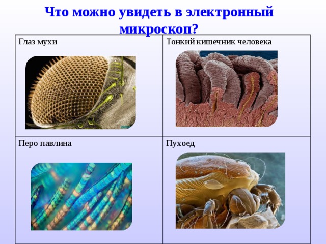 Что можно увидеть в электронный микроскоп? Глаз мухи Тонкий кишечник человека Перо павлина Пухоед 