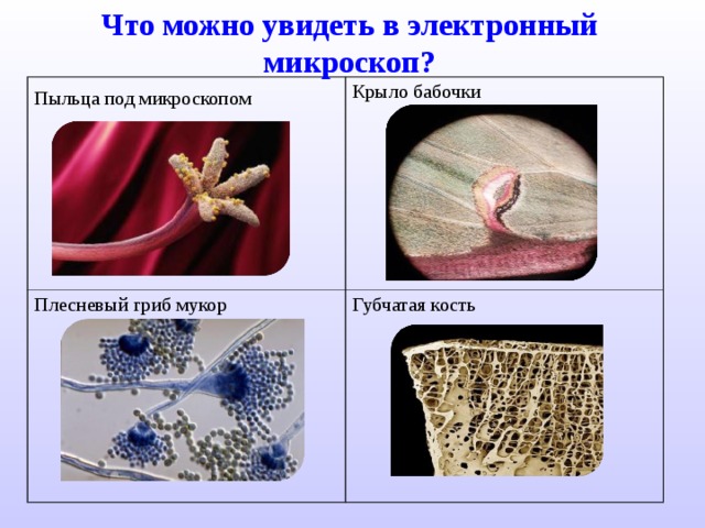 Что можно увидеть в электронный микроскоп? Пыльца под микроскопом  Крыло бабочки Плесневый гриб мукор Губчатая кость 