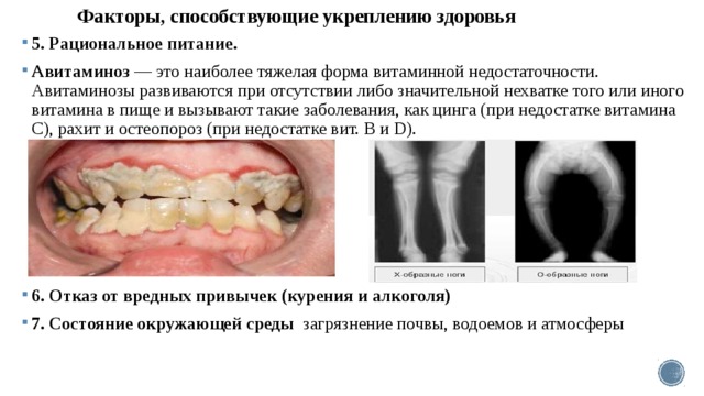 Факторы, способствующие укреплению здоровья   5. Рациональное питание. Авитаминоз — это наиболее тяжелая форма витаминной недостаточности. Авитаминозы развиваются при отсутствии либо значительной нехватке того или иного витамина в пище и вызывают такие заболевания, как цинга (при недостатке ви­тамина С), рахит и остеопороз (при недостатке вит. B и D).      6. Отказ от вредных привычек (курения и алкоголя) 7. Состояние окружающей среды загряз­нение почвы, водоемов и атмосферы 