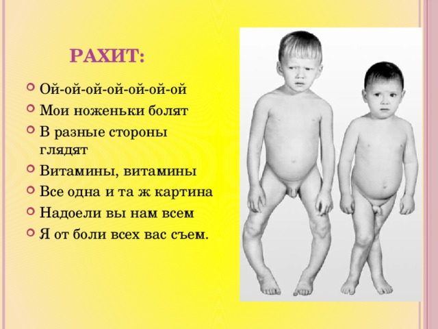 Рахит: Ой-ой-ой-ой-ой-ой-ой Мои ноженьки болят В разные стороны глядят Витамины, витамины Все одна и та ж картина Надоели вы нам всем Я от боли всех вас съем. 