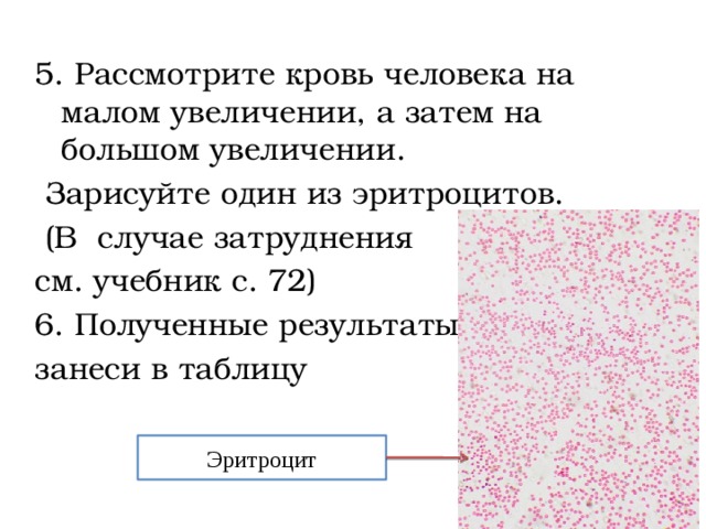5. Рассмотрите кровь человека на малом увеличении, а затем на большом увеличении.  Зарисуйте один из эритроцитов.  (В случае затруднения см. учебник с. 72) 6. Полученные результаты занеси в таблицу Эритроцит 