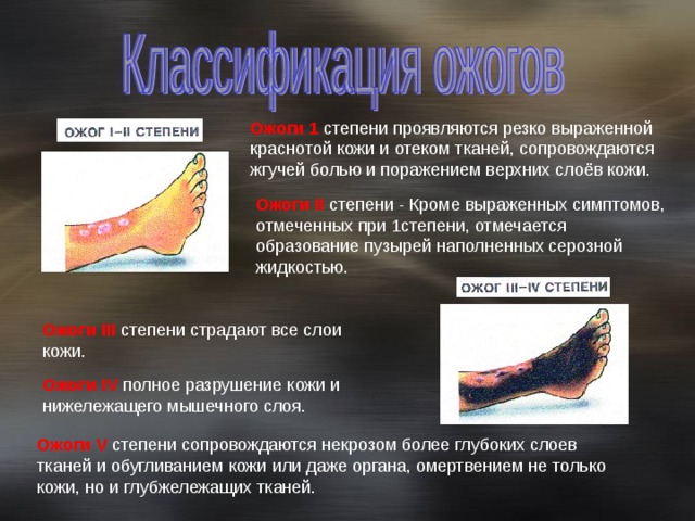 Ожоги обж 9 класс презентация