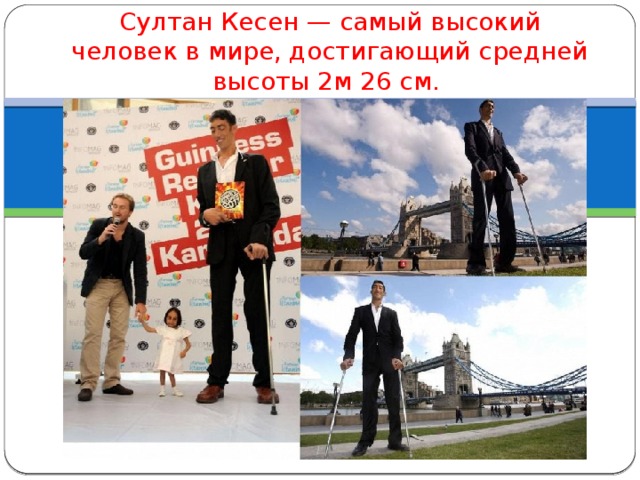 Султан Кесен — самый высокий человек в мире, достигающий средней высоты 2м 26 см. 