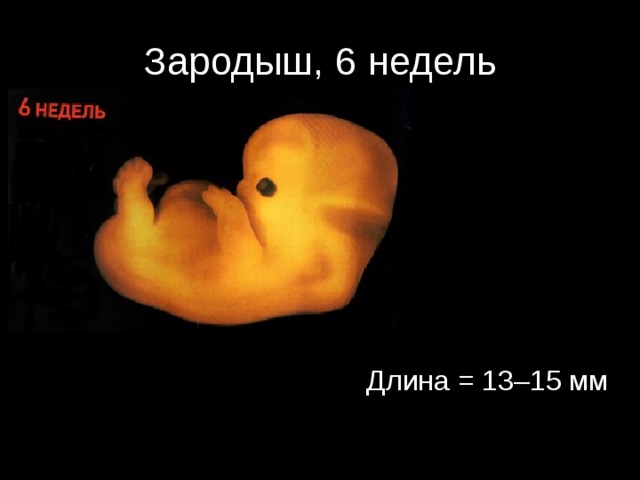 Зародыш, 6 недель Длина = 13–15 мм 