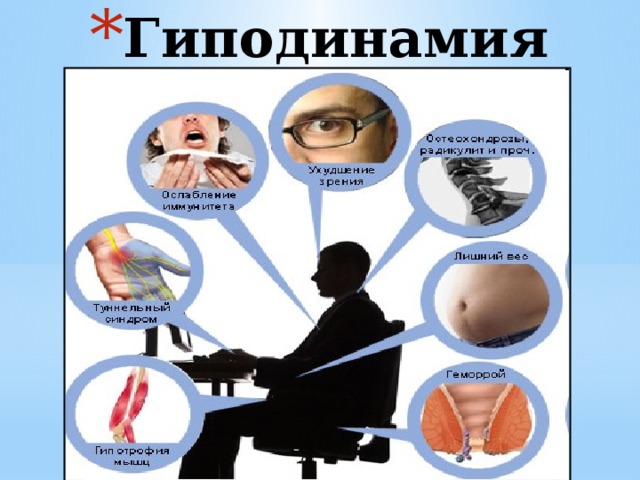Гиподинамия  