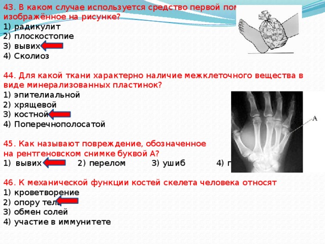 43. В каком случае используется средство первой помощи, изображённое на рисунке? 1) радикулит 2) плоскостопие 3) вывих 4) Сколиоз 44. Для какой ткани характерно наличие межклеточного вещества в виде минерализованных пластинок? 1) эпителиальной 2) хрящевой 3) костной 4) Поперечнополосатой 45. Как называют повреждение, обозначенное на рентгеновском снимке буквой А? вывих 2) перелом 3) ушиб 4) гематома 46. К механической функции костей скелета человека относят 1) кроветворение 2) опору тела 3) обмен солей 4) участие в иммунитете 