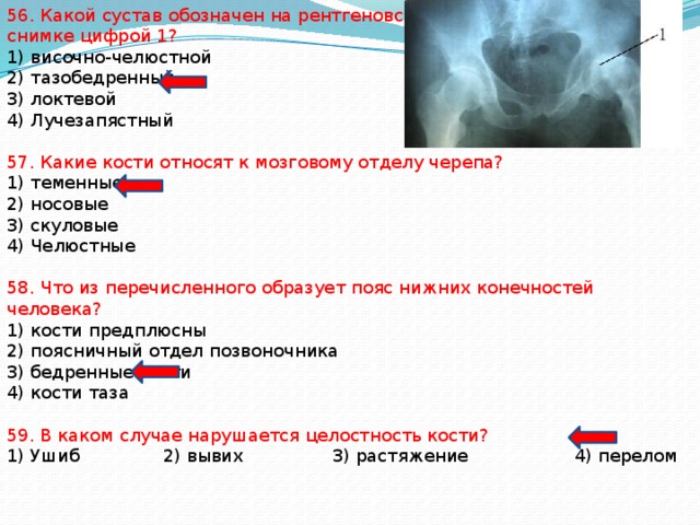 56. Какой сустав обозначен на рентгеновском снимке цифрой 1? 1) височно-челюстной 2) тазобедренный 3) локтевой 4) Лучезапястный 57. Какие кости относят к мозговому отделу черепа? 1) теменные 2) носовые 3) скуловые 4) Челюстные 58. Что из перечисленного образует пояс нижних конечностей человека? 1) кости предплюсны 2) поясничный отдел позвоночника 3) бедренные кости 4) кости таза 59. В каком случае нарушается целостность кости? 1) Ушиб 2) вывих 3) растяжение 4) перелом 