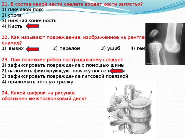 21. В состав какой части скелета входят кости запястья? 1) плечевой пояс 2) стопа 3) нижняя конечность 4) Кисть 22. Как называют повреждение, изображённое на рентгеновском снимке? вывих 2) перелом 3) ушиб 4) гематома 23. При переломе рёбер пострадавшему следует 1) зафиксировать повреждение с помощью шины 2) наложить фиксирующую повязку после выдоха 3) зафиксировать повреждение гипсовой повязкой 4) приложить тёплую грелку 24. Какой цифрой на рисунке обозначен межпозвонковый диск? 