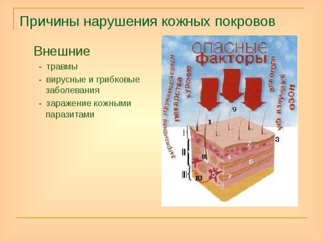 Причины нарушения кожных покровов Внешние  - травмы  - вирусные и грибковые заболевания  - заражение кожными паразитами 