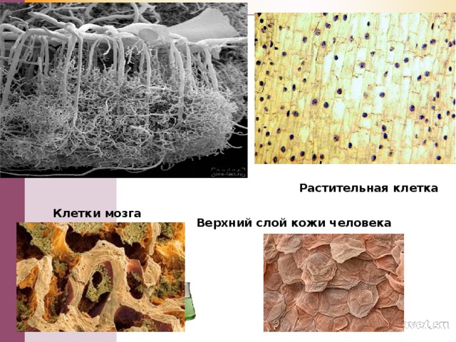 Растительная клетка Клетки мозга Верхний слой кожи человека