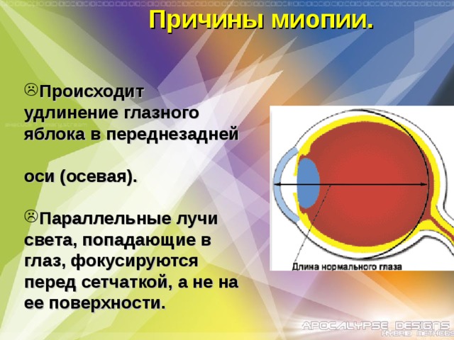 Последовательность лучей света в глазном яблоке