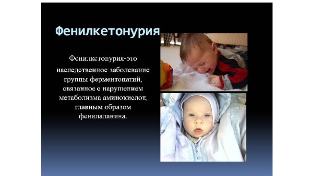 Материнская фенилкетонурия презентация