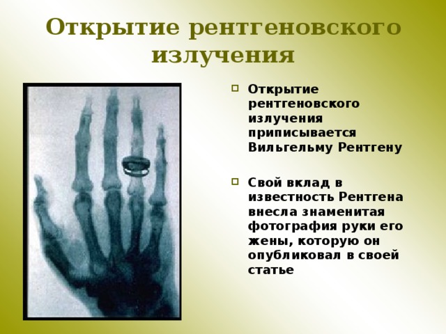 Открытие рентгеновского излучения  Открытие рентгеновского излучения приписывается Вильгельму Рентгену  Свой вклад в известность Рентгена внесла знаменитая фотография руки его жены, которую он опубликовал в своей статье 