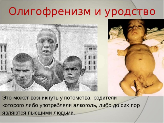 Олигофренизм и уродство Это может возникнуть у потомства, родители которого либо употребляли алкоголь, либо до сих пор являются пьющими людьми. 