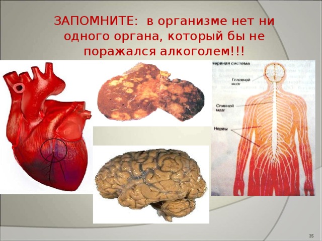 ЗАПОМНИТЕ: в организме нет ни одного органа, который бы не поражался алкоголем!!!  