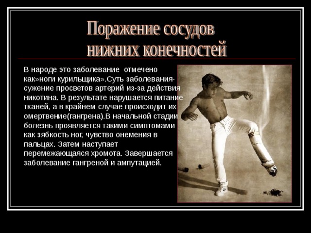 В народе это заболевание отмечено как»ноги курильщика».Суть заболевания- сужение просветов артерий из-за действия никотина. В результате нарушается питание тканей, а в крайнем случае происходит их омертвение(гангрена).В начальной стадии болезнь проявляется такими симптомами как зябкость ног, чувство онемения в пальцах. Затем наступает перемежающаяся хромота. Завершается заболевание гангреной и ампутацией.